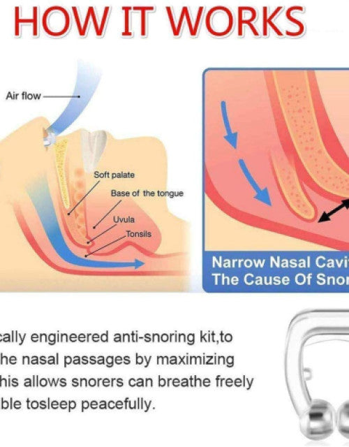 Anti Snoring Device for Men Women Magnetic Snoring Stopper Nose Clip Snore free Anti-snoring Device  (Nose Clip)